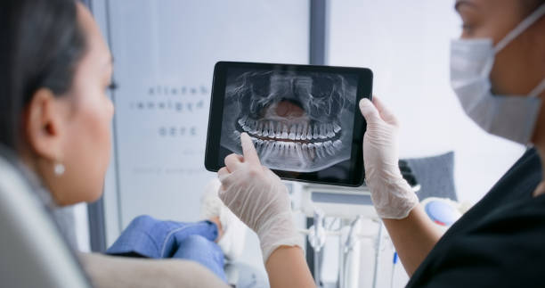 Licensed Root Canal Treatment service in Mountain Village, CO - Smile Center Dentistry